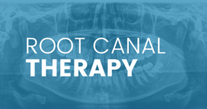 The Truth of Root Canal Therapy