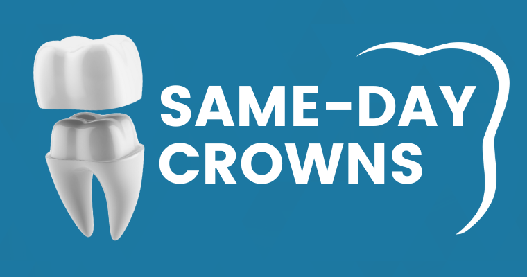 Same Day Dentistry: CEREC Crowns
