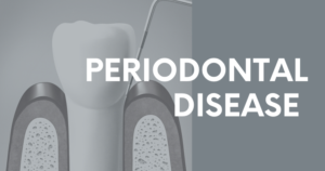 Periodontal Disease Blog Header